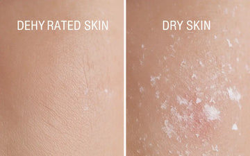 Dry vs Dehydrated Skin