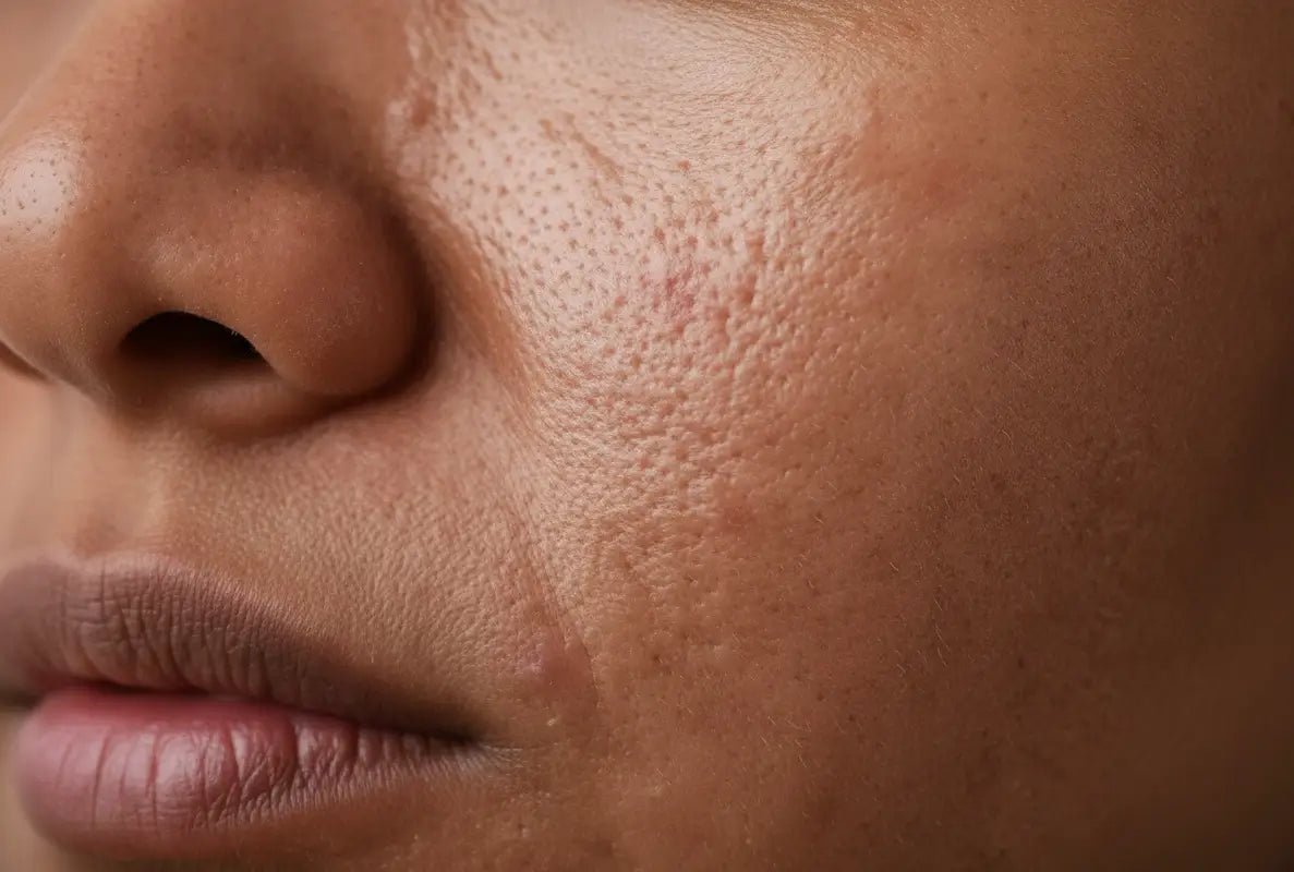 How to Get Rid of Texture on Face: Complete Guide - Vixxar Cosmetiques